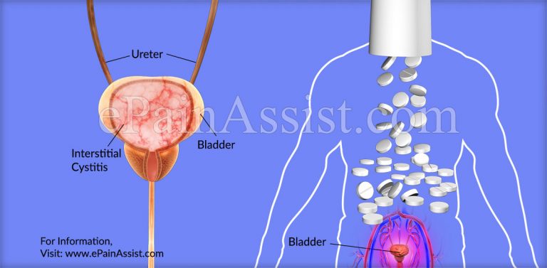 Is Long-Term Antibiotics Treatment Good For Interstitial Cystitis?