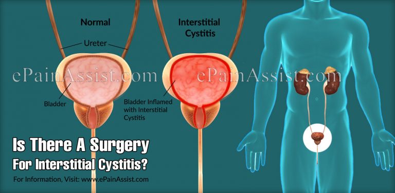 Is There A Surgery For Interstitial Cystitis & Life Expectancy Of Someone With It?