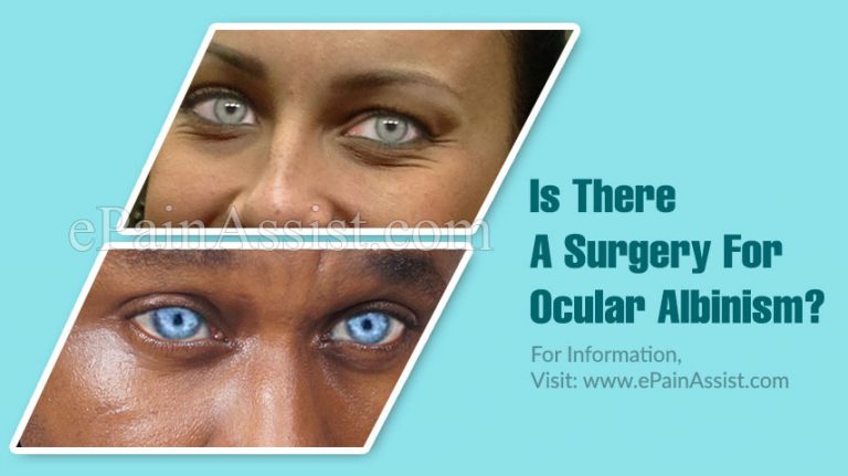 Is There A Surgery For Ocular Albinism?