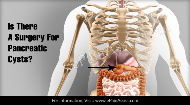 Is There A Surgery For Pancreatic Cysts & What Is The Most Common Surgery For It?