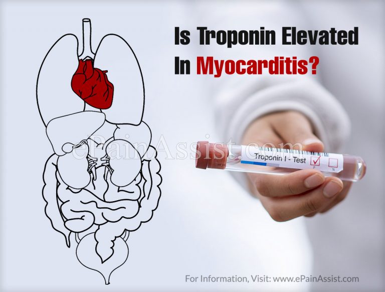 Is Troponin Elevated In Myocarditis?