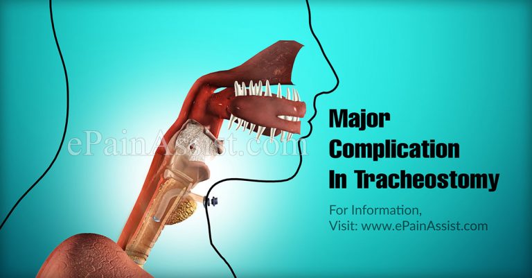 Major Complication In Tracheostomy & Can You Talk After A Tracheostomy Is Removed?