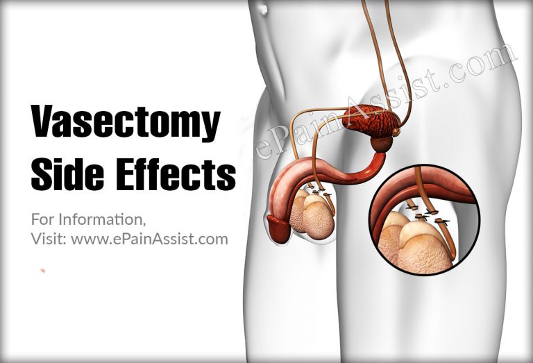 Vasectomy Side Effects & Can Vasectomy Cause ED?