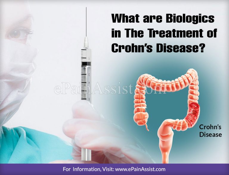 What are Biologics in The Treatment of Crohn’s Disease & What are Its Side Effects?