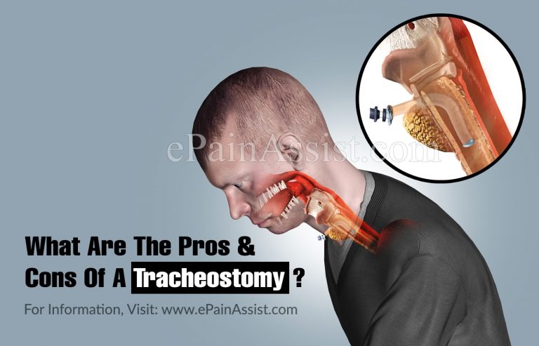 What Are The Pros And Cons Of A Tracheostomy?