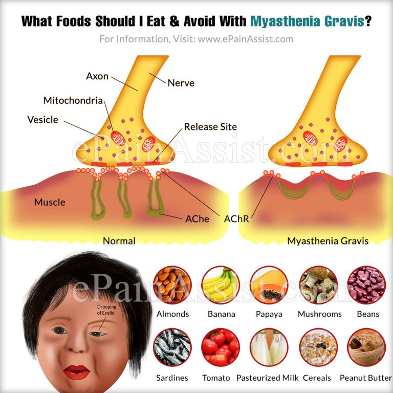 What Foods Should I Eat & Avoid With Myasthenia Gravis?