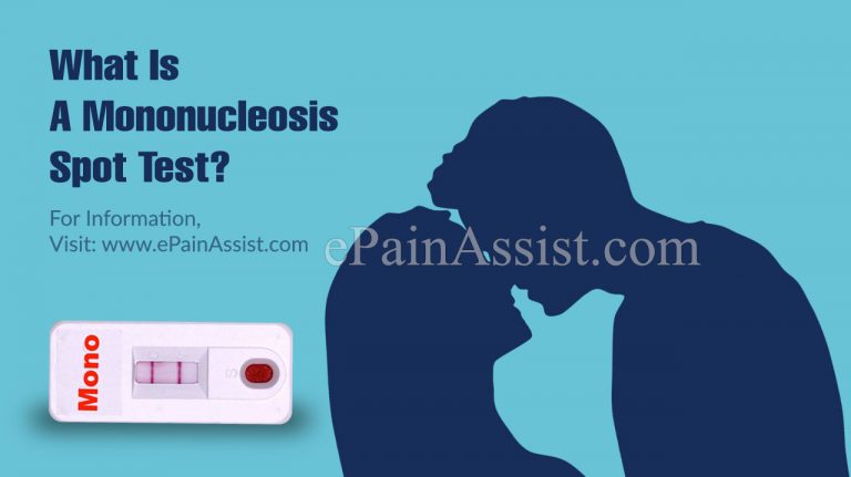 What Is A Mononucleosis Spot Test?