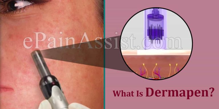 What Is Dermapen & How Often Should You Use It?