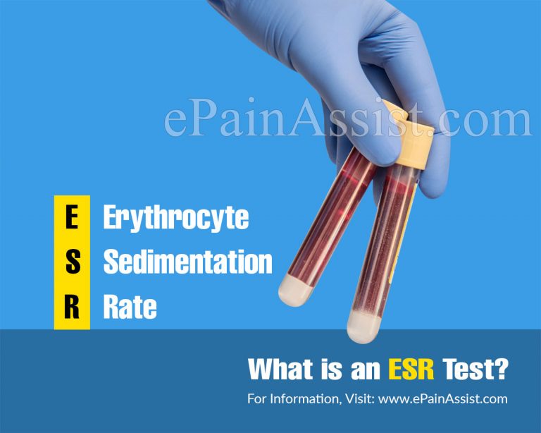 Why Is ESR Test Done & How Is It Done? | What Diseases Cause High ESR & What Happens If ESR is High?
