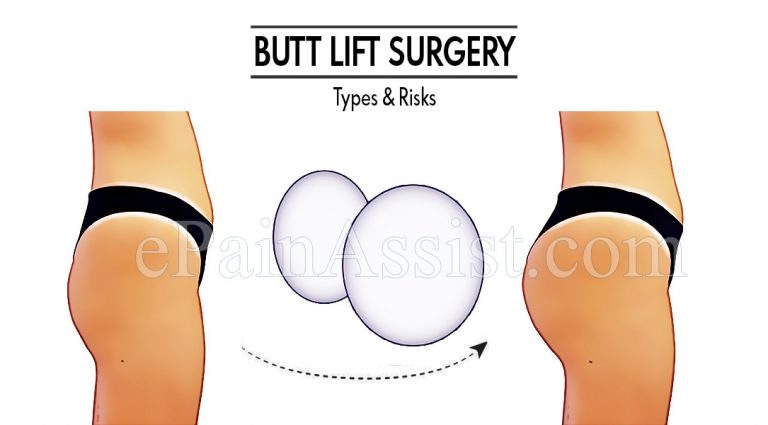 Butt Lift Surgery: Types & Risks