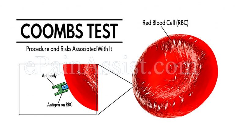 Coombs Test: Procedure, Conditions That Lead To Positive Coombs Test and Risks Associated With It