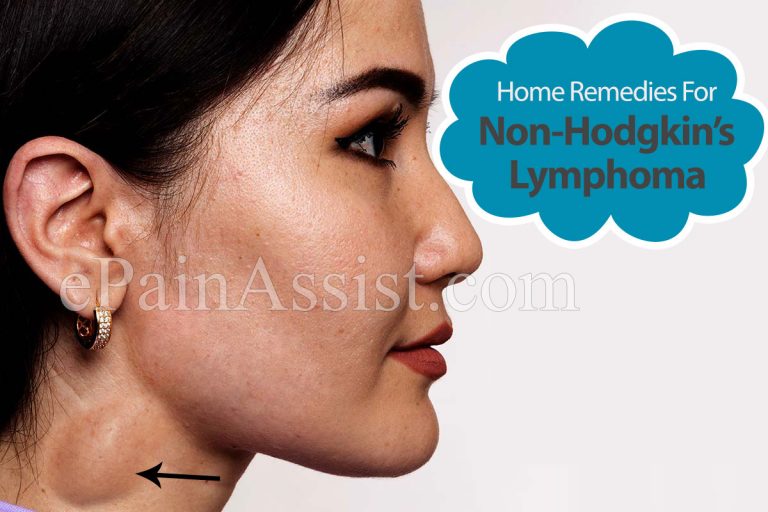 Home Remedies For Non-Hodgkin’s Lymphoma