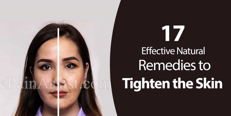 17 Effective Natural Remedies to Tighten the Skin