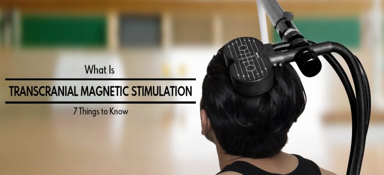 What Is Transcranial Magnetic Stimulation? 7 Things to Know
