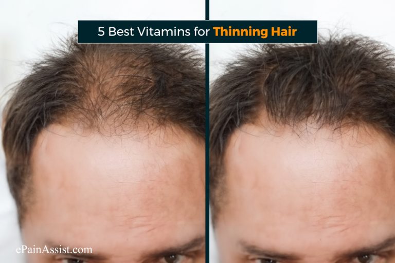 5 Best Vitamins for Thinning Hair