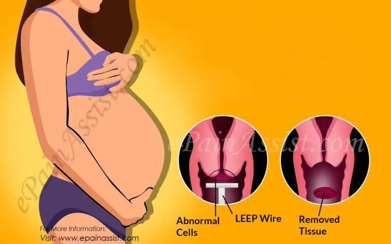 Can You Have A Baby After a LEEP Procedure?