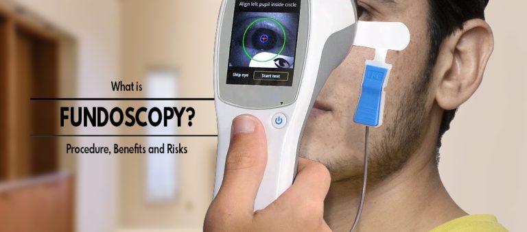 Fundoscopy : Procedure, Benefits, Limitations and Risks