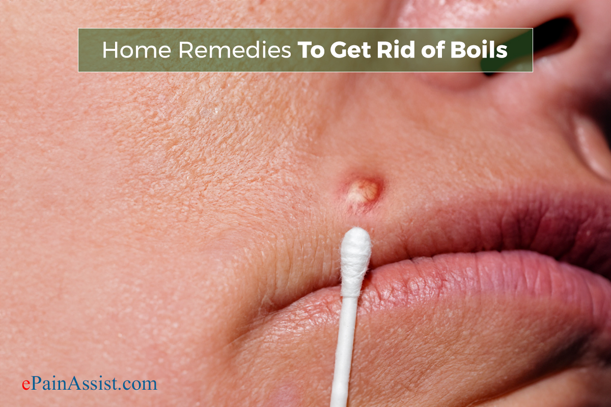 Home Remedies To Get Rid of Boils