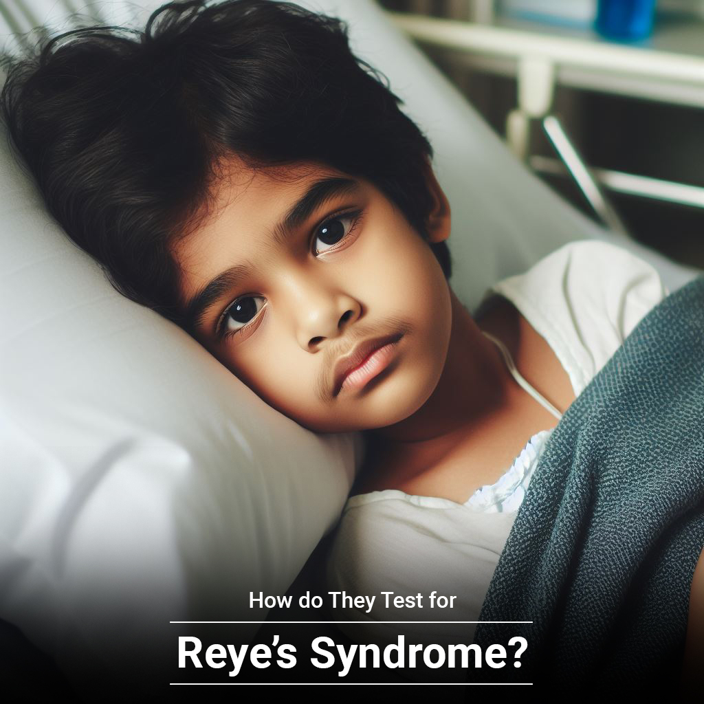 How do They Test for Reye's Syndrome?