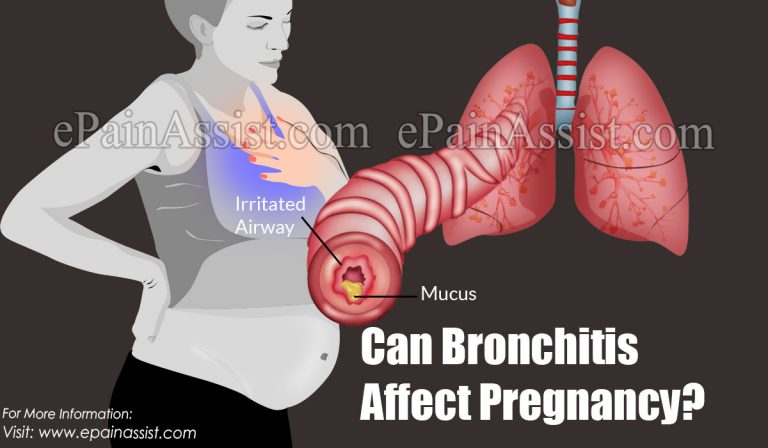Can Bronchitis Affect Pregnancy?