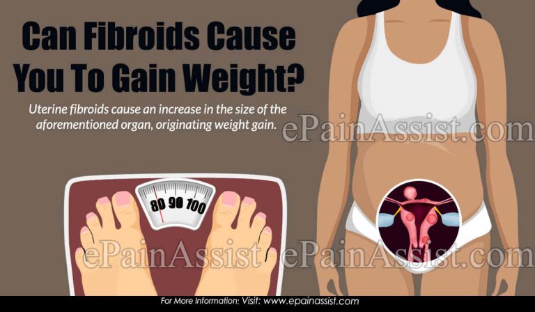 Can Fibroids Cause You To Gain Weight?