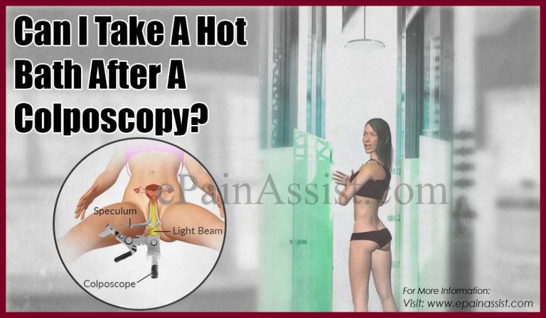 Can I Take A Hot Bath After A Colposcopy?