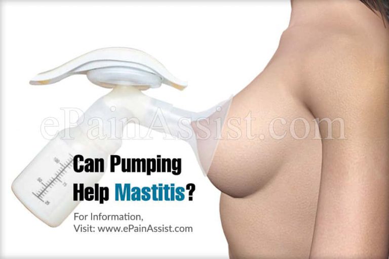 Can Pumping Help Mastitis?