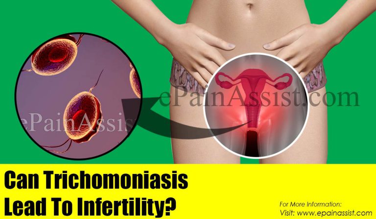 Can Trichomoniasis Lead To Infertility?