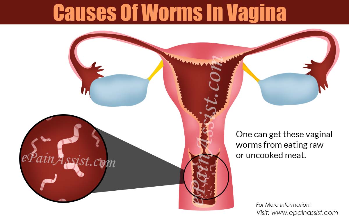 Causes Of Worms In Vagina