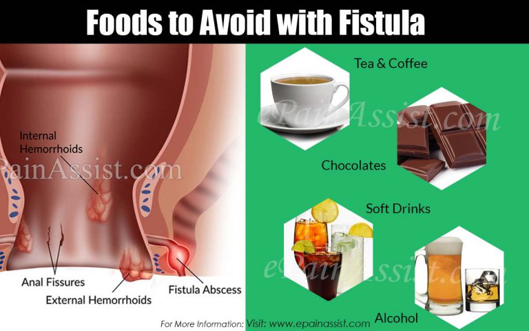 Foods to Avoid with Fistula