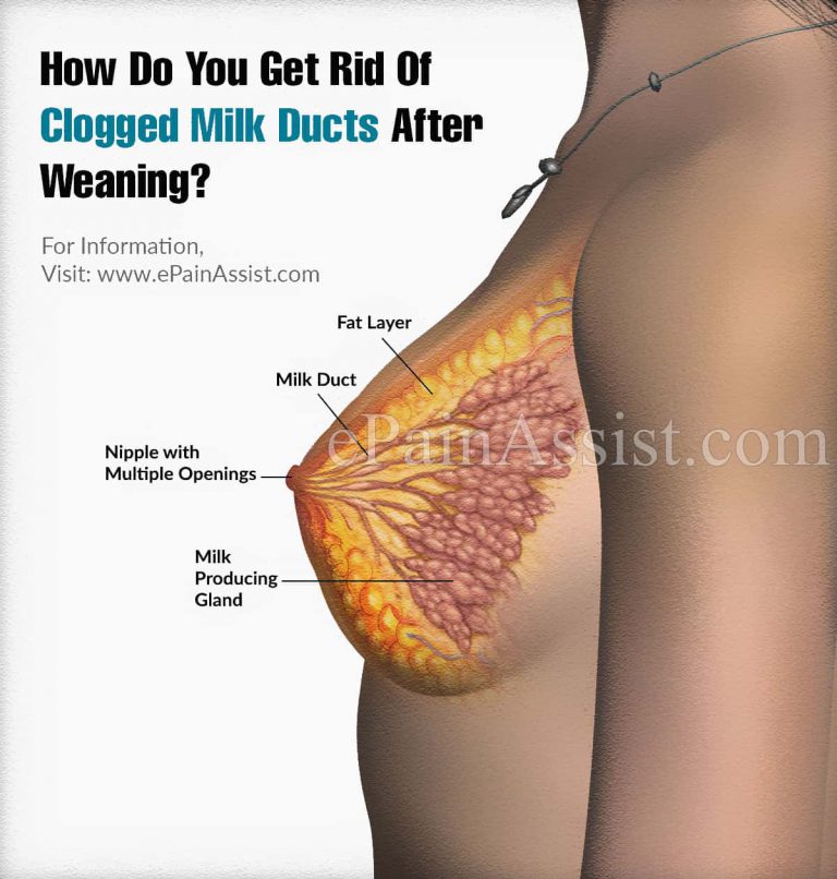 How Do You Get Rid Of Clogged Milk Ducts After Weaning?