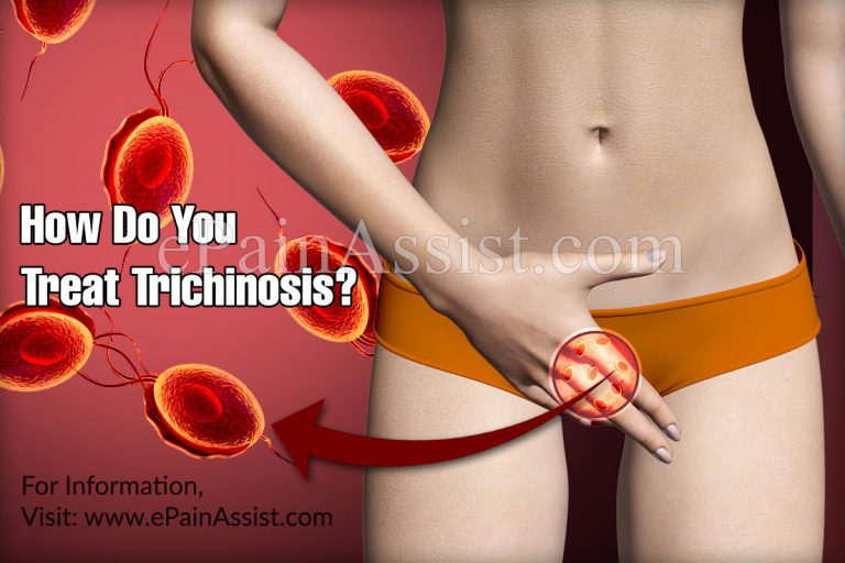 How Do You Treat Trichinosis?