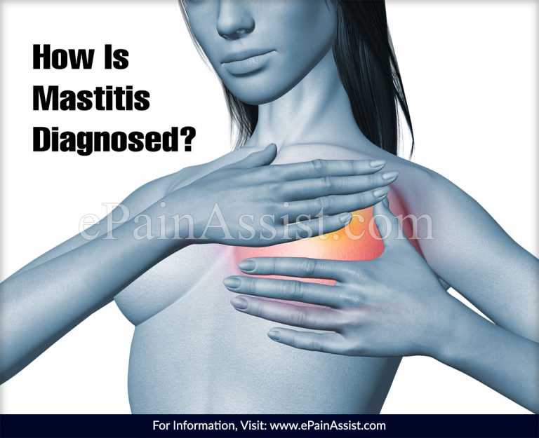 How Is Mastitis Diagnosed?