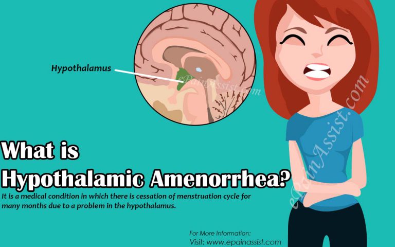 Hypothalamic Amenorrhea: Causes, Treatment, Diagnosis