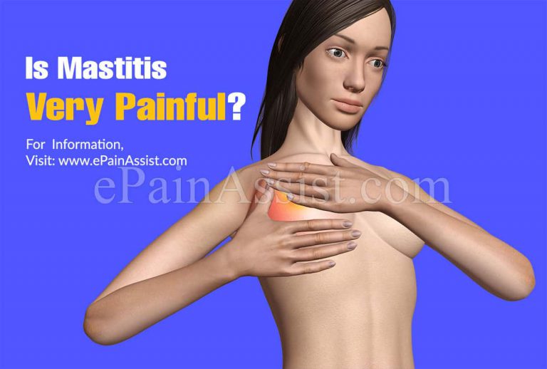 Is Mastitis Very Painful?
