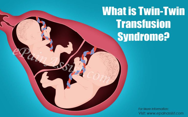 What is Twin-Twin Transfusion Syndrome & How is it Treated?
