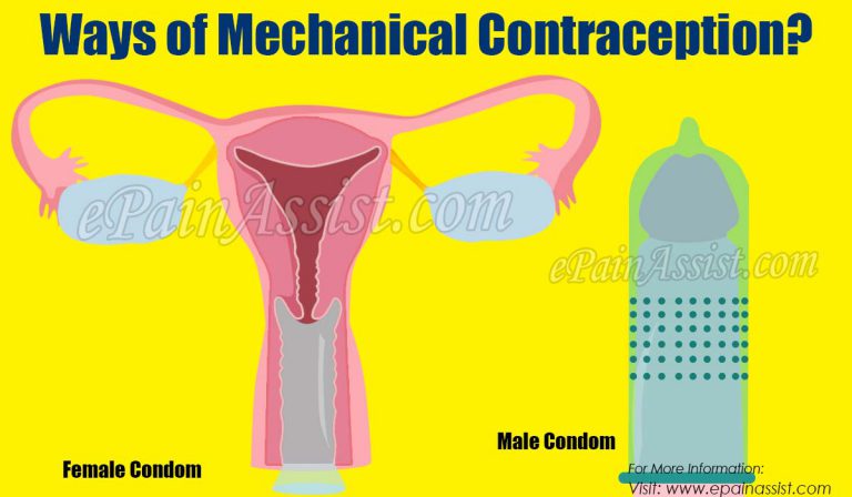 Ways of Mechanical Contraception
