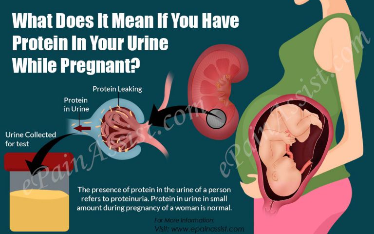 What Does It Mean If You Have Protein In Your Urine While Pregnant?