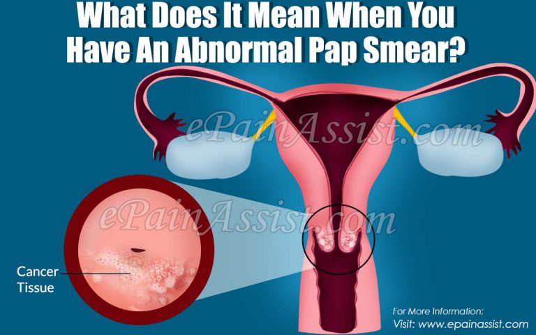 What Does It Mean When You Have An Abnormal Pap Smear?