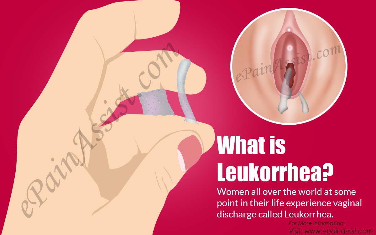 What is Leukorrhea?