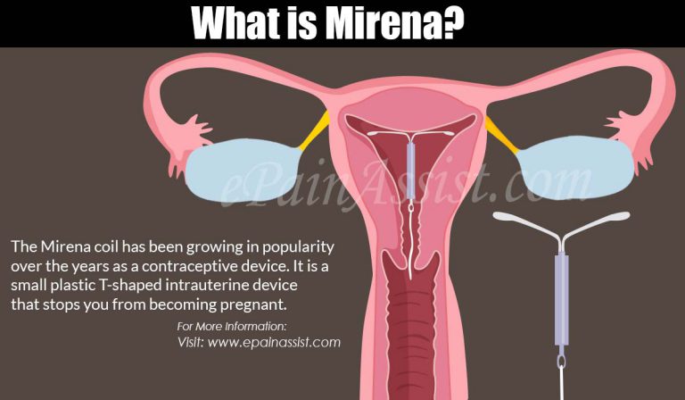 How Does Mirena Help Treat Endometriosis?
