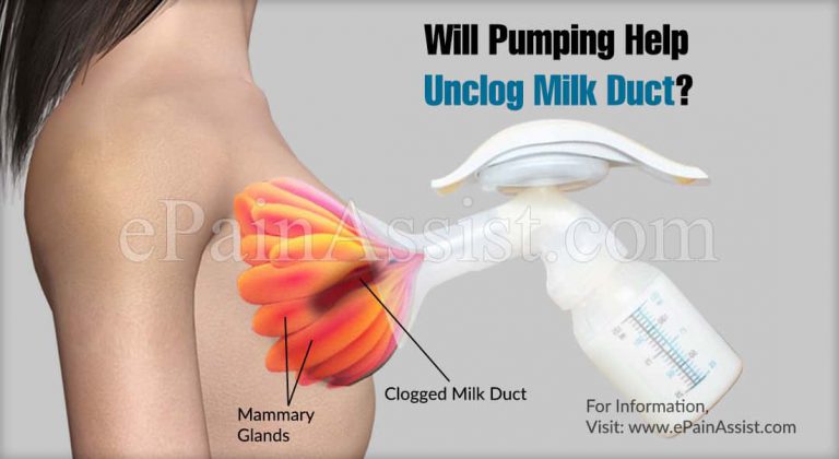 Will Pumping Help Unclog Milk Duct?