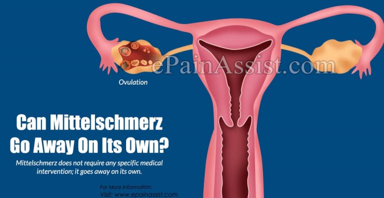 Can Mittelschmerz Go Away On Its Own?