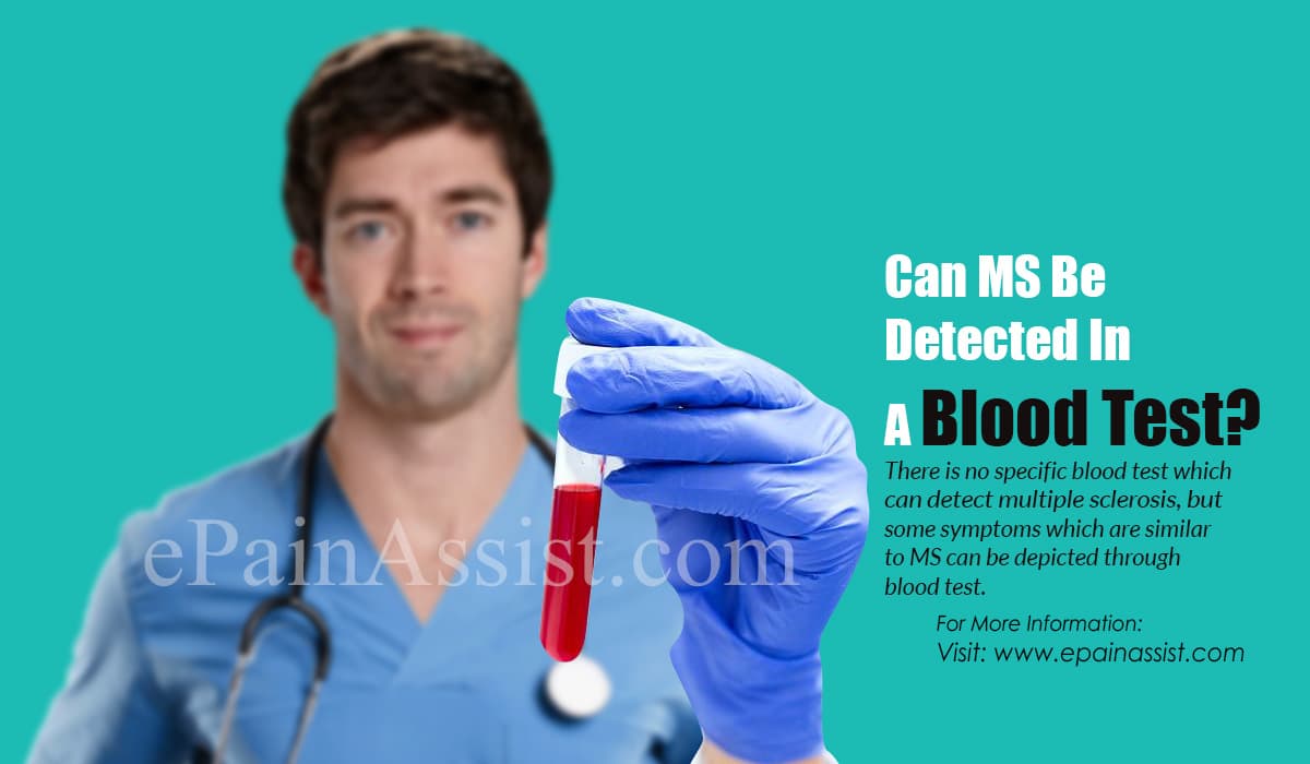 Can MS Be Detected In A Blood Test?