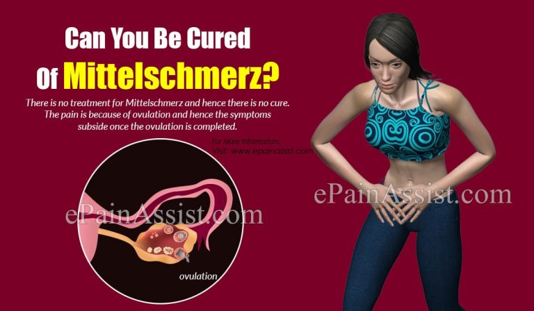 Can You Be Cured Of Mittelschmerz?