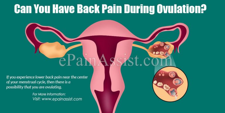 Can You Have Back Pain During Ovulation?