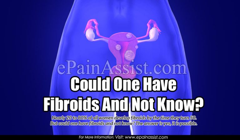 Could One Have Fibroids And Not Know?