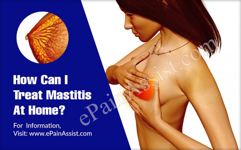 How Can I Treat Mastitis At Home?
