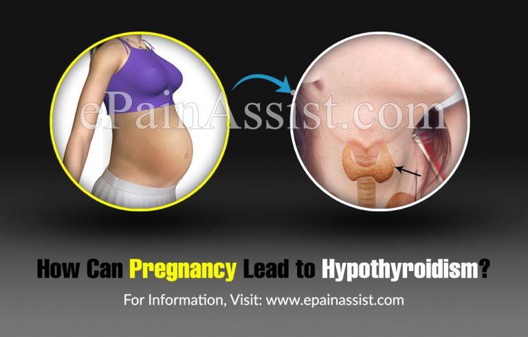 How Can Pregnancy Lead to Hypothyroidism?