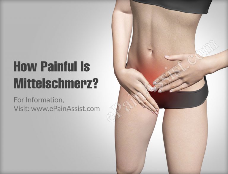 How Painful Is Mittelschmerz?